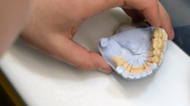 Diş Crown diş teknisyeni biler. bir diş Bileme ve parlatma molar kron birtakım teknisyeni omuz çekim üzerinde.