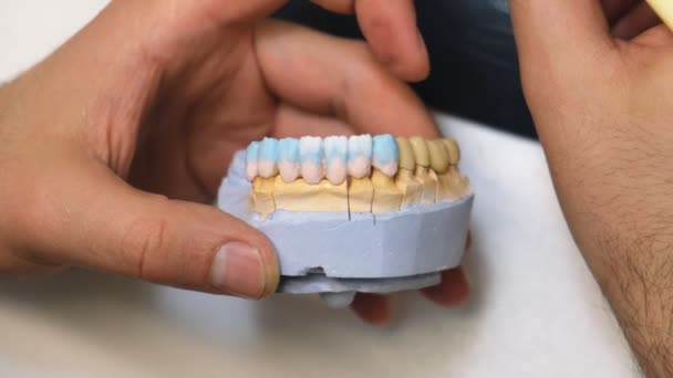 Dental Technician Grinds Tooth Crown Sobre Hombro Técnico Dental Moliendo — Vídeos de Stock