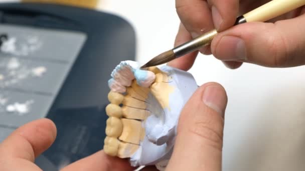 牙科技术员磨牙冠 在牙科技师的肩部拍摄 研磨和抛光一套磨牙冠 — 图库视频影像