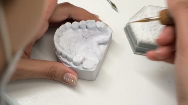 Diş Crown Diş Teknisyeni Biler Bir Diş Bileme Parlatma Molar — Stok video