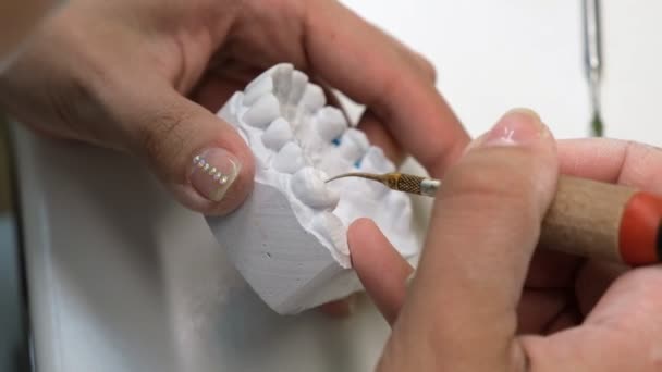 Dental Technician Grinds Tooth Crown Sobre Ombro Tiro Técnico Odontológico — Vídeo de Stock