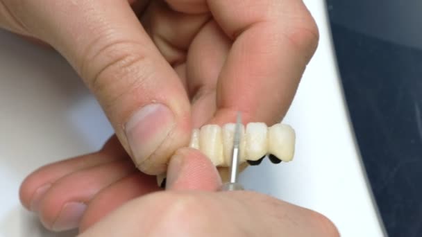 Стоматолог Млини Ручної Роботи Зубні Коронки Стоматолог Який Працює Керамічними — стокове відео