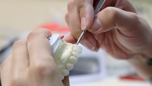 Dental Technician Work Prosthesis Production Teeth Prototype Construction — Stock Video