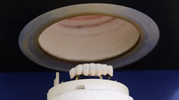 Ceramiczne Piekarnik Korony Dentystyczne — Wideo stockowe