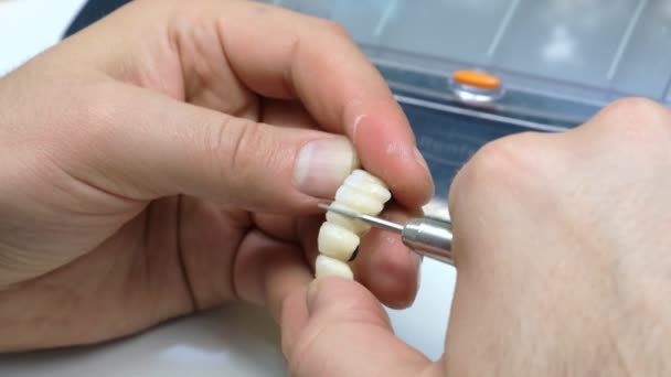 Dentiste Broyeurs Main Couronnes Dentaires Technicien Dentaire Travaillant Avec Des — Video