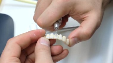 Diş hekimi el değirmenleri kronlar diş. Diş teknisyeni seramik kron diş laboratuvar ile çalışma