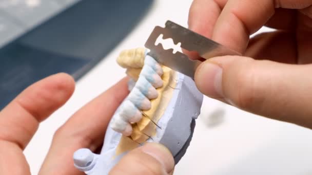 牙科技师的工作 假肢生产 牙齿原型结构 — 图库视频影像
