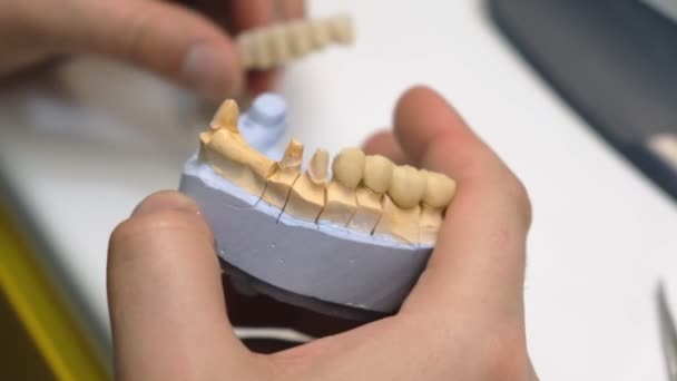 Dental Technician Work Prosthesis Production Teeth Prototype Construction — Stock Video