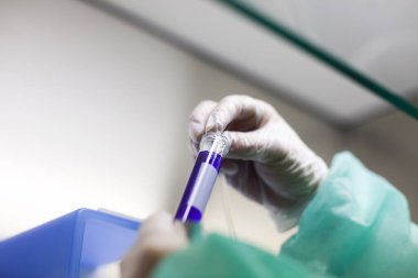 Laboratuvarda bir test tüpünü bilimsel olarak manipüle etmek.