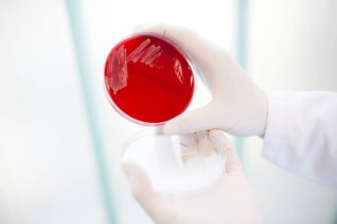 Kırmızı ekin tepsisi tutan bir bilim adamının elleri.