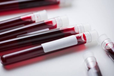 Beyaz arka planda kan örnekleri, COVID-19 testi için kan örnekleri.