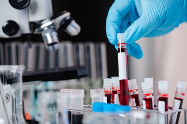 Doktor ya da bilim adamı. Raftan kan testi tüpü alın.