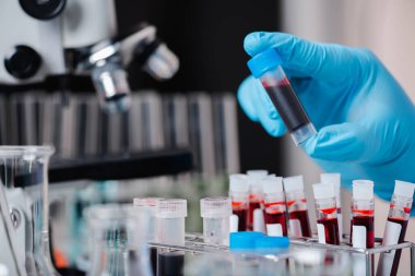 Doktor ya da bilim adamı. Raftan kan testi tüpü alın.