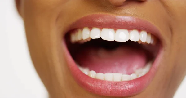 Close Van Afrikaanse Vrouw Met Witte Tanden Glimlachen — Stockfoto