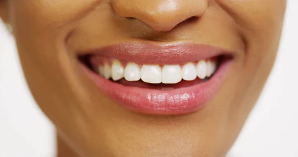 Close Van Afrikaanse Vrouw Met Witte Tanden Glimlachen — Stockfoto