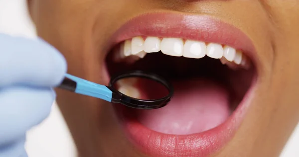 Primer Plano Sonriente Mujer Negra Dentista — Foto de Stock