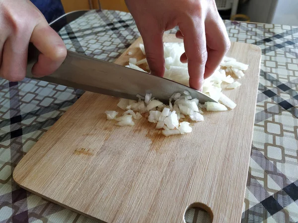 Tahta kesme tahtasıyla soğan doğrayan kadın.