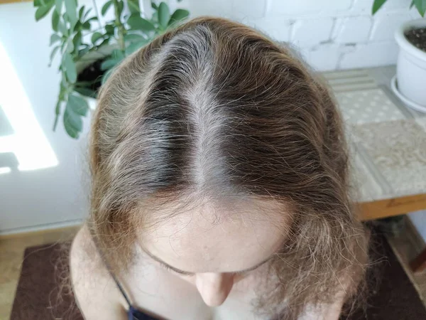 Graue Haare Auf Dem Kopf Einer Frau — Stockfoto