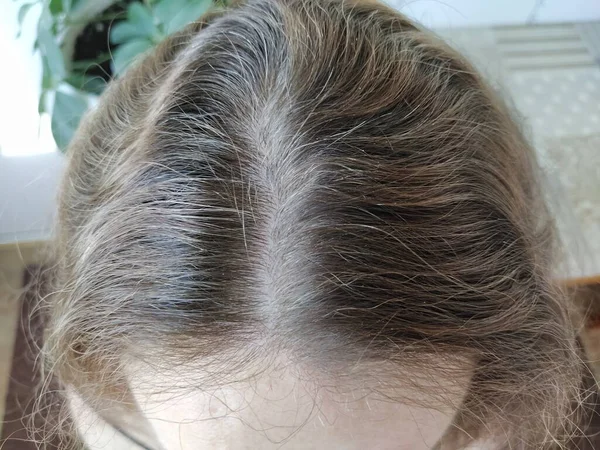 Γκρι Μαλλιά Στο Κεφάλι Μιας Γυναίκας Κοντά — Φωτογραφία Αρχείου