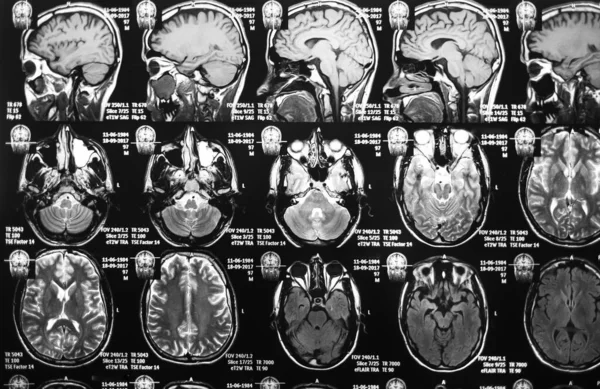 Magnetic resonance scan of the brain. MRI head scan. Medicine, science