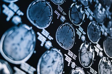 Beynin manyetik rezonans taraması. MRI kafa taraması. Tıp, bilim.