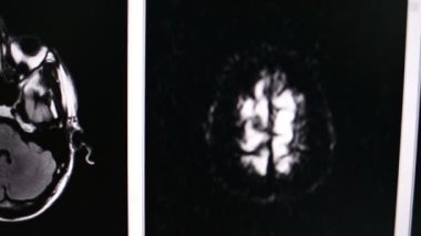 MRI beyin taraması görüntüleri