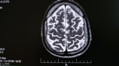 Röntgen, manyetik rezonans görüntüleme
