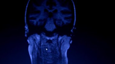Koyu arkaplanda boyun ve baş MRI 'da.