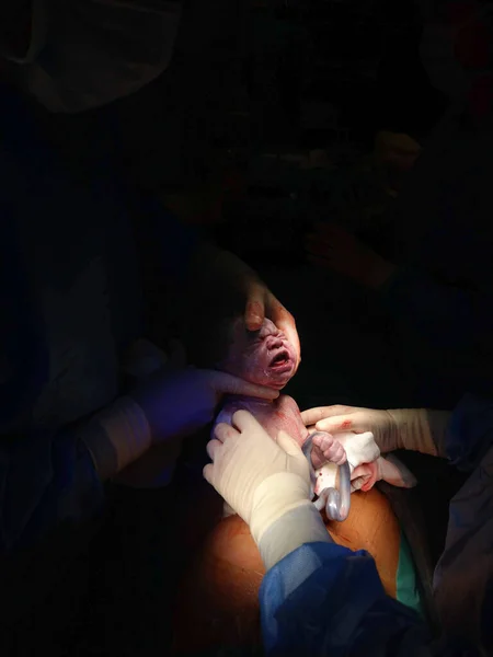 maternity operating room the moment a woman gives birth - cesarean section - a girl with seconds to liv