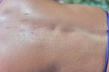 Kadınların sırtlarını ter damlalarıyla parçala. Güneşli yaz günü, yakın çekim, üst manzara