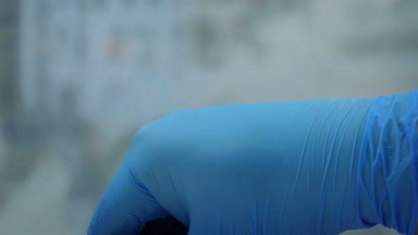 İzleme cihazı Implant vücut kaldırılır