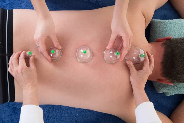 Fire vacuum cupping Treatment On man Back by four women hands