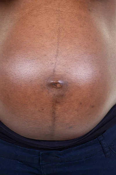 Africká Žena Těhotná Břicho Černé Tuňáci Closeup — Stock fotografie