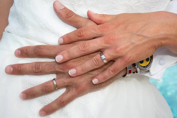 Couple Hands Wedding Ring Marriage Day — Stock Photo, Image