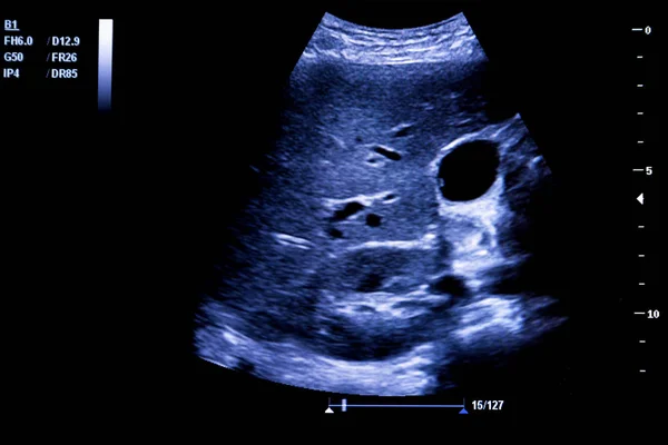 Imagine Colorată Monitorului Modern Ultrasunete Masina Ultrasonografie Echipamente Medicale Medicale — Fotografie, imagine de stoc