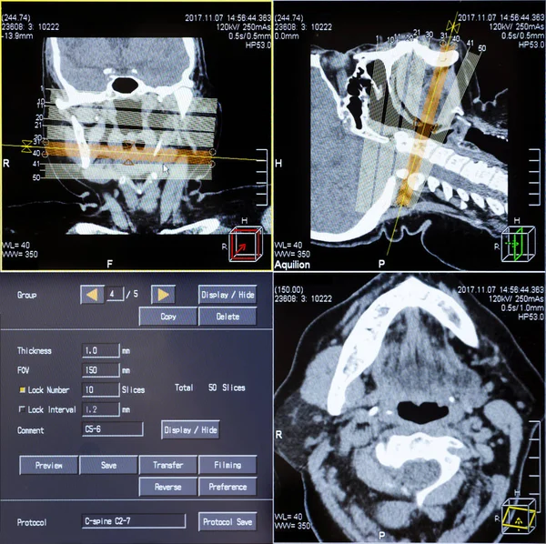 Magnetic Resonance Imaging Mri Scan Scans Human Head Ultrasound Computer — Stock Photo, Image