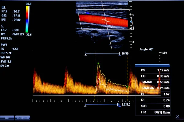 Colourful Image Modern Ultrasound Monitor Ultrasonography Machine High Technology Medical — Stock Photo, Image