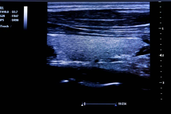 Kolorowy Obraz Usg Nowoczesny Monitor Ultrasonografia Maszyny Medycznego Sprzętu Wysokiej — Zdjęcie stockowe