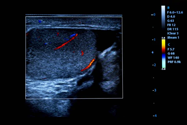 Kolorowy Obraz Usg Nowoczesny Monitor Ultrasonografia Maszyny Medycznego Sprzętu Wysokiej — Zdjęcie stockowe