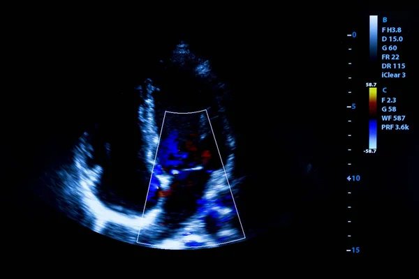 Kleurrijke Afbeelding Van Moderne Echografie Monitor Ultrasonografie Machine High Tech — Stockfoto