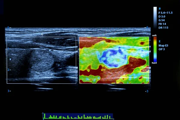Kolorowy obraz USG nowoczesny monitor — Zdjęcie stockowe
