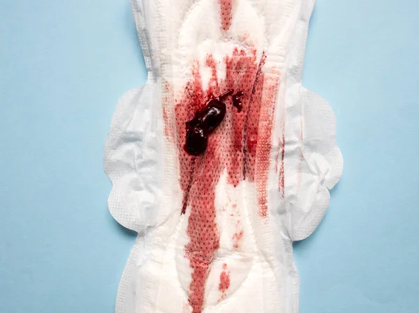 Symptom Endometriosis Menstrual Blood Blood Clots Sanitary Pad Stock Photo  by ©VittoriaChe 525308158