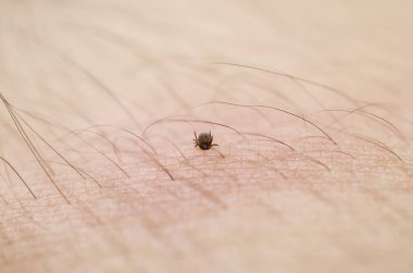 mite cilt makro üzerinde