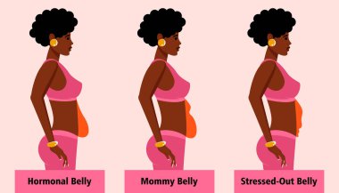 Afro-Amerikan kadınları için dişi karın tipleri. Menopozlu hormonal karın, şişmiş karın ve aşırı stresli karın. Vektör illüstrasyonu