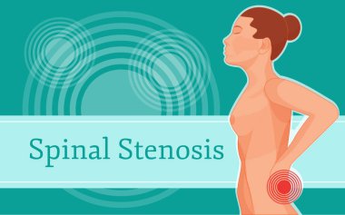 Spinal stenoz ağrı vücut. Ağrı insan vücudu nedeni.