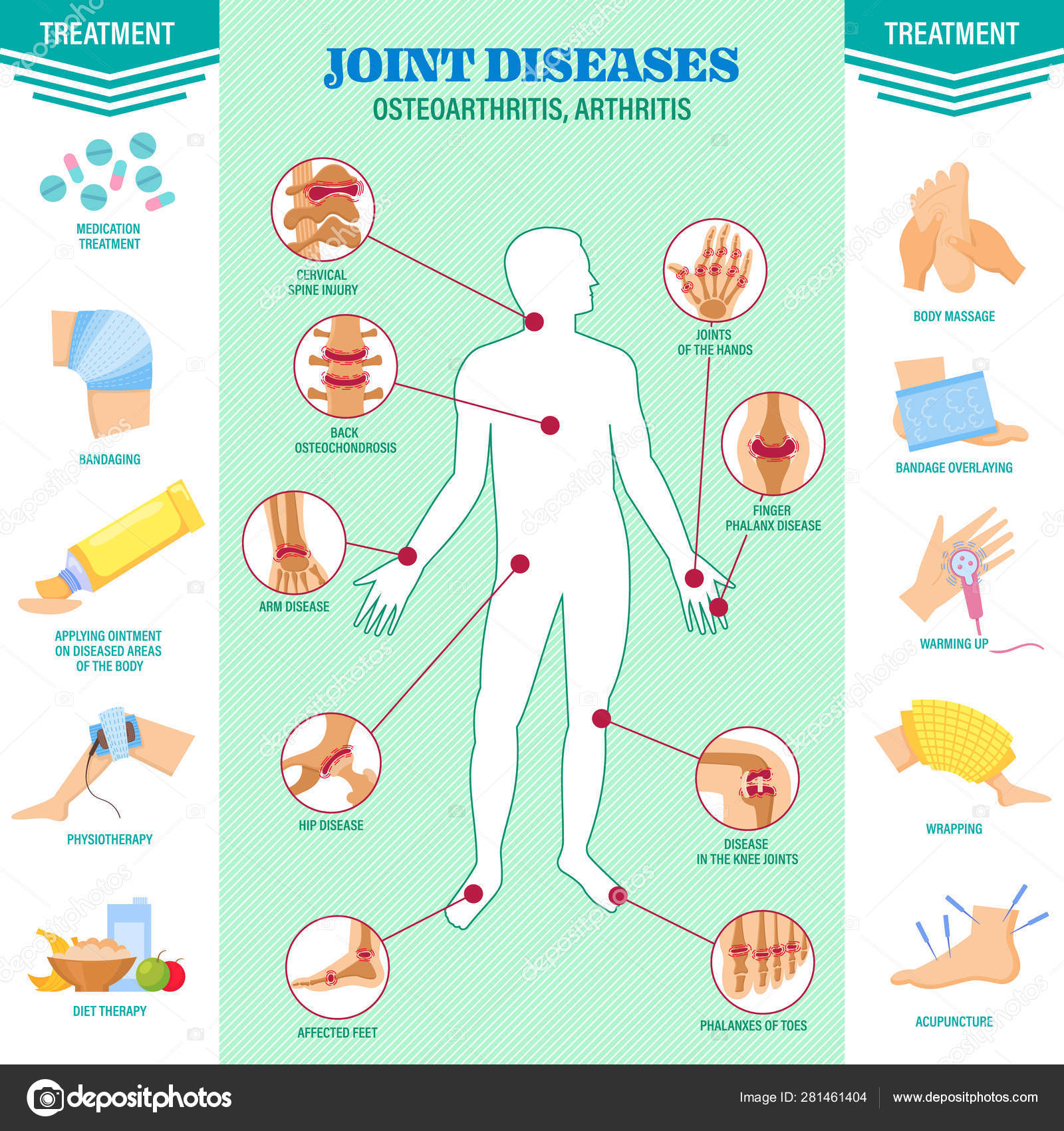 Spine problem. Joints diseases pain. Arthritis, osteoarthritis symptoms