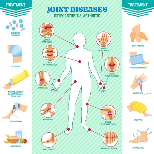 Spine problem. Joints diseases pain. Arthritis, osteoarthritis symptoms, medication treatment — Stock Vector