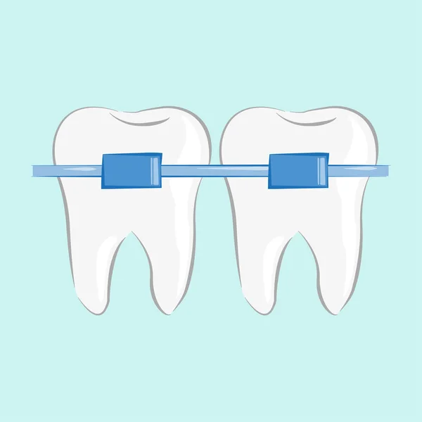 Braçadeiras Dentes Estilo Plano Ilustração Vetorial Design Elegante — Vetor de Stock