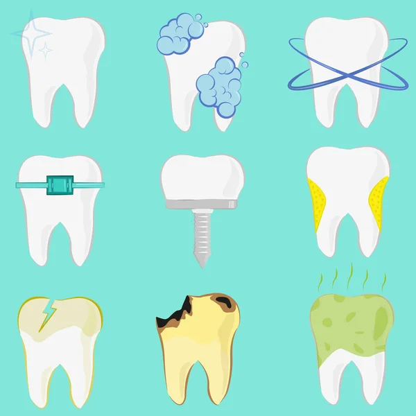 Conjunto Diferentes Dientes Implante Caries Diente Limpio — Archivo Imágenes Vectoriales