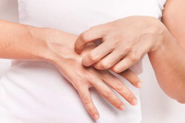 Vrouw Krabt Aan Haar Hand — Stockfoto